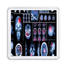 Магнит 55*55 с принтом неврология в Новосибирске, Пластик | Размер: 65*65 мм; Размер печати: 55*55 мм | 