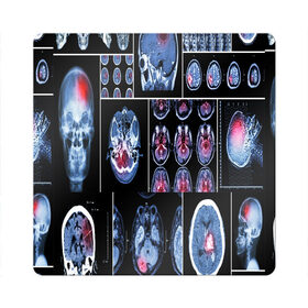Магнит виниловый Квадрат с принтом неврология в Новосибирске, полимерный материал с магнитным слоем | размер 9*9 см, закругленные углы | 