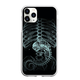 Чехол для iPhone 11 Pro Max матовый с принтом Чужой на Рентгене в Новосибирске, Силикон |  | alien | больница | больной | внутренний мир | врач | клиника | кости | пациент | ребра | рентген | скелет | снимок | хищник