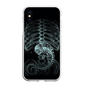 Чехол для iPhone XS Max матовый с принтом Чужой на Рентгене в Новосибирске, Силикон | Область печати: задняя сторона чехла, без боковых панелей | alien | больница | больной | внутренний мир | врач | клиника | кости | пациент | ребра | рентген | скелет | снимок | хищник