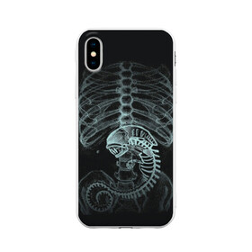 Чехол для iPhone X матовый с принтом Чужой на Рентгене в Новосибирске, Силикон | Печать на задней стороне чехла, без боковой панели | Тематика изображения на принте: alien | больница | больной | внутренний мир | врач | клиника | кости | пациент | ребра | рентген | скелет | снимок | хищник