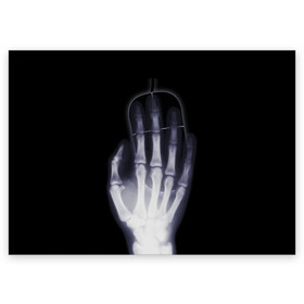 Поздравительная открытка с принтом X-Ray hand в Новосибирске, 100% бумага | плотность бумаги 280 г/м2, матовая, на обратной стороне линовка и место для марки
 | Тематика изображения на принте: hand | mouse | x ray | мышка | рука